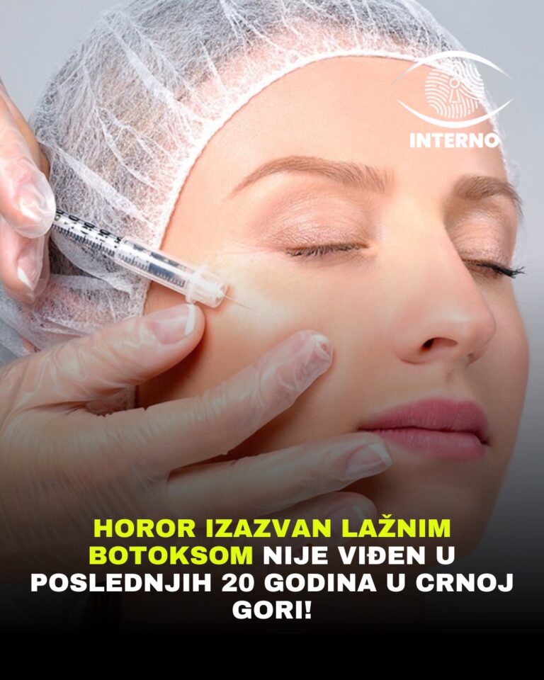 Horor izazvan lažnim botoksom nije viđen u poslednjih 20 godina u Crnoj Gori!